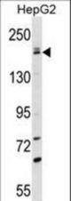 PNPLA6 Antibody western blot of HepG2 cell line lysates (35 ug/lane). The PNPLA6 antibody detected the PNPLA6 protein (arrow).