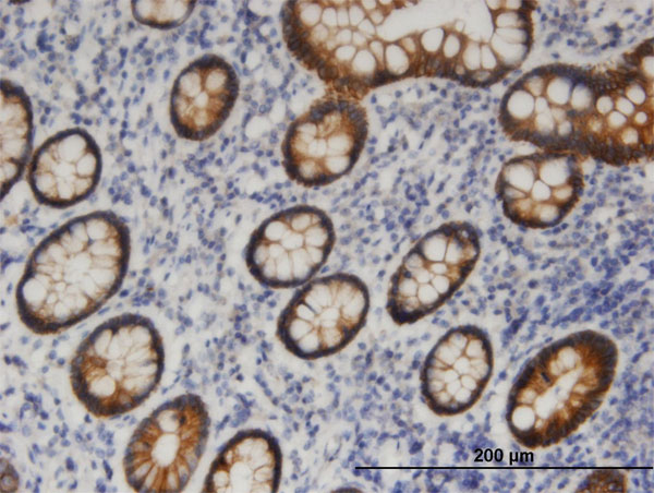 Immunoperoxidase of monoclonal antibody to PNPLA6 on formalin-fixed paraffin-embedded human small Intestine. [antibody concentration 3 ug/ml]