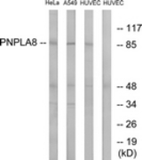 Western blot of extracts from HUVEC/HeLa/A549 cells, using PNPLA8 Antibody. The lane on the right is treated with the synthesized peptide.