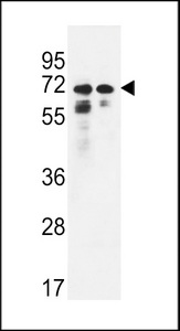 PNPLA8 Antibody western blot of HeLa,K562 cell line lysates (35 ug/lane). The PNPLA8 antibody detected the PNPLA8 protein (arrow).