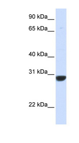 PNPO antibody LS-C102793 Western blot of Fetal Muscle lysate.