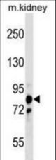 PNPT1 Antibody western blot of mouse kidney tissue lysates (35 ug/lane). The PNPT1 antibody detected the PNPT1 protein (arrow).
