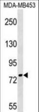 PNPT1 Antibody western blot of MDA-MB453 cell line lysates (35 ug/lane). The PNPT1 antibody detected the PNPT1 protein (arrow).