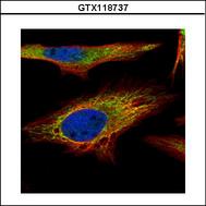 Confocal immunofluorescence analysis (Olympus FV10i) of paraformaldehyde-fixed HeLa using PNPase antibody (Green) at 1:500 dilution. Alpha-tubulin filaments were labeled with alpha-tubulin antibody (Red) at 1:2500.