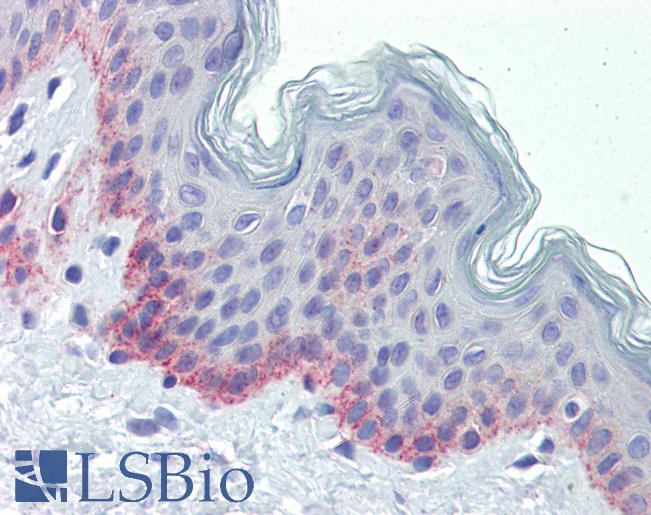 Anti-PNPT1 antibody IHC of human skin. Immunohistochemistry of formalin-fixed, paraffin-embedded tissue after heat-induced antigen retrieval. Antibody LS-B3544 concentration 5 ug/ml.