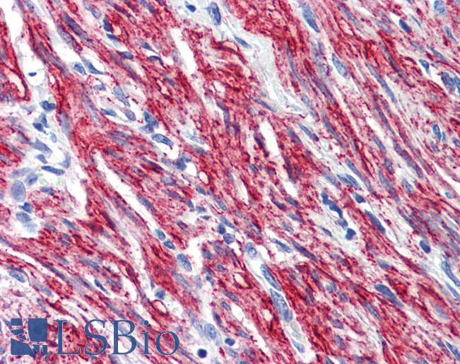 Anti-PNPT1 antibody IHC of human uterus, myometrium. Immunohistochemistry of formalin-fixed, paraffin-embedded tissue after heat-induced antigen retrieval. Antibody LS-B3544 concentration 5 ug/ml.