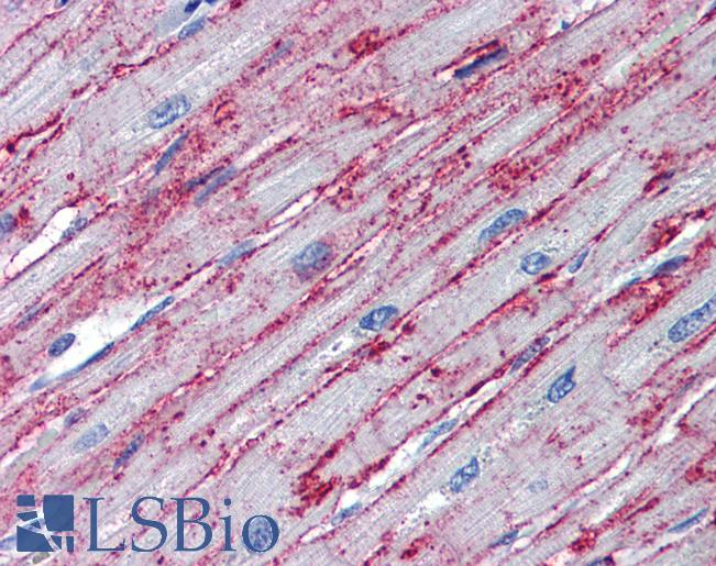 Anti-PNPT1 antibody IHC of human heart. Immunohistochemistry of formalin-fixed, paraffin-embedded tissue after heat-induced antigen retrieval. Antibody LS-B3544 concentration 5 ug/ml.
