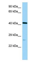 POC1A / SOFT antibody Western Blot of Rat Pancreas.
