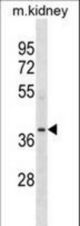 POC1A Antibody western blot of mouse kidney tissue lysates (35 ug/lane). The POC1A antibody detected the POC1A protein (arrow).