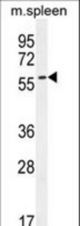 CE037 Antibody western blot of mouse spleen tissue lysates (35 ug/lane). The CE037 antibody detected the CE037 protein (arrow).