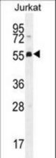 PODNL1 Antibody western blot of Jurkat cell line lysates (35 ug/lane). The PODNL1 antibody detected the PODNL1 protein (arrow).