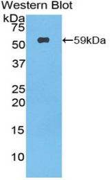 Western blot of recombinant PODXL / Podocalyxin.