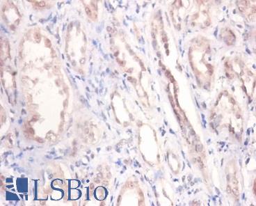 Immunohistochemistry of paraffin-embedded human kidney using PODXL / Podocalyxin antibody at dilution of 1:100.