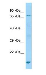 POF1B antibody Western Blot of Jurkat.