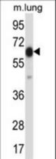 POF1B Antibody western blot of mouse lung tissue lysates (35 ug/lane). The POF1B antibody detected the POF1B protein (arrow).