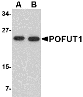Western blot of POFUT1 in human heart tissue lysate with POFUT1 antibody at (A) 0.5 and (B) 1 ug/ml.