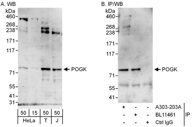 Detection of Human POGK by Western Blot and Immunoprecipitation. Samples: Whole cell lysate from HeLa (15 and 50 ug for WB; 1 mg for IP, 20% of IP loaded), 293T (T; 50 ug) and Jurkat (J; 50 ug) cells. Antibodies: Affinity purified rabbit anti-POGK antibody used for WB at 0.1 ug/ml (A) and 1 ug/ml (B) and used for IP at 6 ug/mg lysate. POGK was also immunoprecipitated by rabbit anti-POGK antibody BL11461, which recognizes a downstream epitope. Detection: Chemiluminescence with exposure times of 3 minutes (A) and 30 seconds (B).