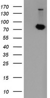 HEK293T cells were transfected with the pCMV6-ENTRY control (Left lane) or pCMV6-ENTRY POGK (Right lane) cDNA for 48 hrs and lysed. Equivalent amounts of cell lysates (5 ug per lane) were separated by SDS-PAGE and immunoblotted with anti-POGK.