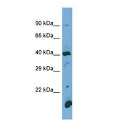 Western blot of Human Jurkat. POGLUT1 antibody dilution 1.0 ug/ml.
