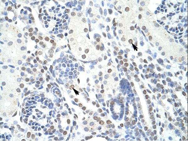 POGZ antibody LS-C31514 was used in IHC to stain formalin-fixed, paraffin-embedded human kidney.