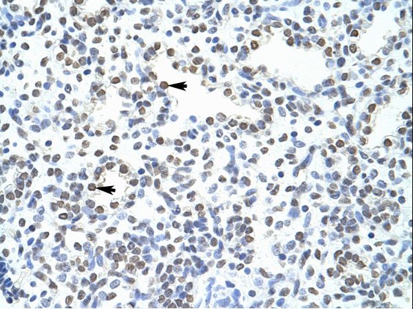 POGZ antibody LS-C31514 was used in IHC to stain formalin-fixed, paraffin-embedded human lung.