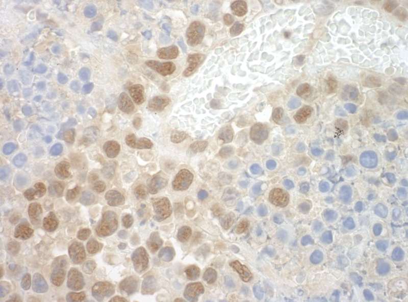 Detection of Mouse POGZ by Immunohistochemistry. Sample: FFPE section of mouse hybridoma tumor. Antibody: Affinity purified rabbit anti-POGZ used at a dilution of 1:250.