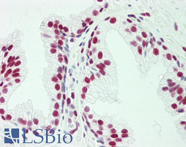 Anti-POGZ antibody IHC staining of human prostate. Immunohistochemistry of formalin-fixed, paraffin-embedded tissue after heat-induced antigen retrieval. Antibody LS-B10611 concentration 5 ug/ml.