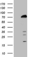 HEK293T cells were transfected with the pCMV6-ENTRY control (Left lane) or pCMV6-ENTRY POLA2 (Right lane) cDNA for 48 hrs and lysed. Equivalent amounts of cell lysates (5 ug per lane) were separated by SDS-PAGE and immunoblotted with anti-POLA2 (1:2000).