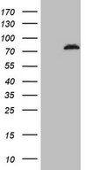 HEK293T cells were transfected with the pCMV6-ENTRY control (Left lane) or pCMV6-ENTRY POLA2 (Right lane) cDNA for 48 hrs and lysed. Equivalent amounts of cell lysates (5 ug per lane) were separated by SDS-PAGE and immunoblotted with anti-POLA2 (1:2000).