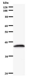 Western blot of immunized recombinant protein using POLA2 antibody.