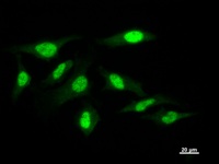 Immunostaining analysis in HeLa cells. HeLa cells were fixed with 4% paraformaldehyde and permeabilized with 0.1% Triton X-100 in PBS. The cells were immunostained with anti-POLA2 mAb.