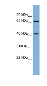 POLB / DNA Polymerase Beta antibody LS-C107570 Western blot of HT1080 cell lysate.