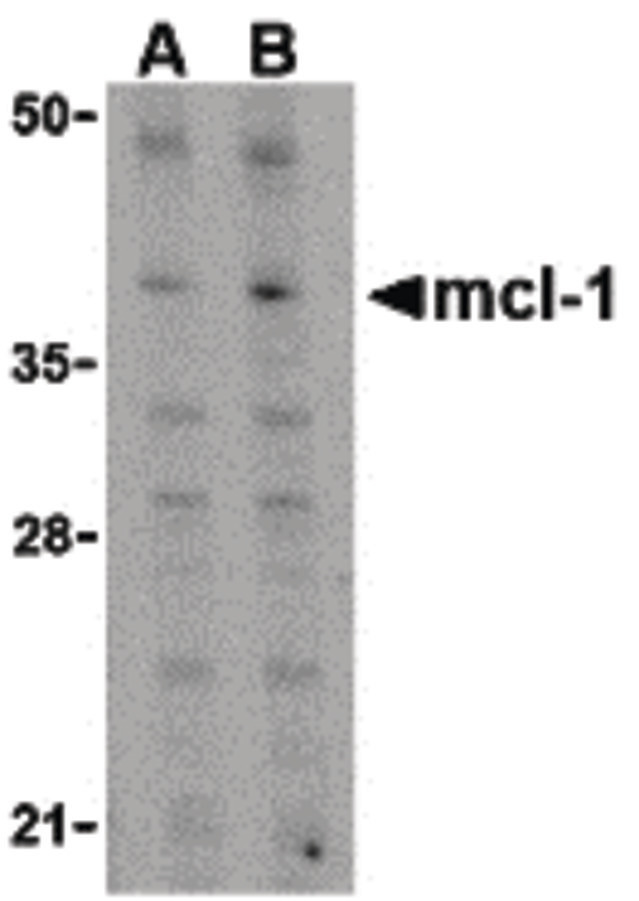 Western blot of Mcl-1 in Raji cell lysates with Mcl-1 antibody at (A) 1 and (B) 2 ug/ml.