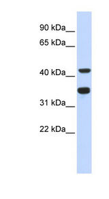 POLD2 antibody LS-C111183 Western blot of Fetal Heart lysate.