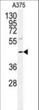 Western blot of POLDIP2 antibody in A375 cell line lysates (35 ug/lane). POLDIP2 (arrow) was detected using the purified antibody.