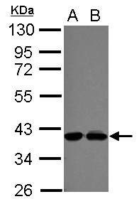 Sample (30 ug of whole cell lysate) A: NT2D1 B: U87-MG 10% SDS PAGE POLDIP3 / SKAR antibody diluted at 1:1000