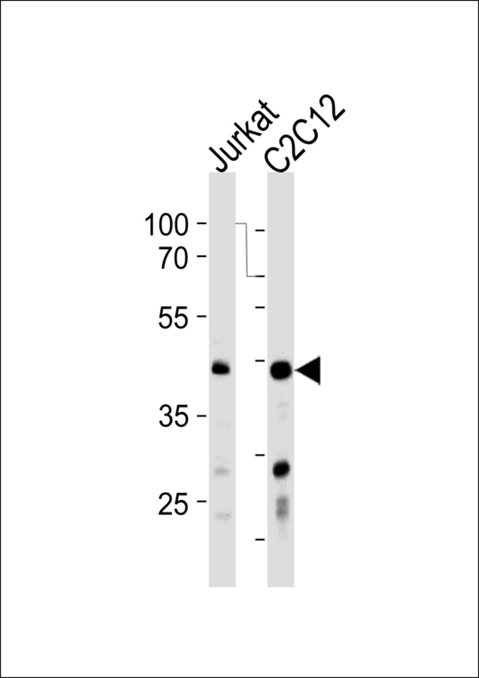 POLDIP3 Antibody western blot of Jurkat,mouse C2C12 cell line lysates (35 ug/lane). The POLDIP3 Antibody antibody detected the POLDIP3 Antibody protein (arrow).