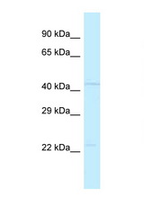 POLDIP3 / SKAR antibody LS-C145972 Western blot of 3 Cell lysate. Antibody concentration 1 ug/ml.