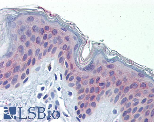Anti-POLDIP3 / SKAR antibody IHC of human skin. Immunohistochemistry of formalin-fixed, paraffin-embedded tissue after heat-induced antigen retrieval. Antibody LS-B3543 concentration 10 ug/ml.
