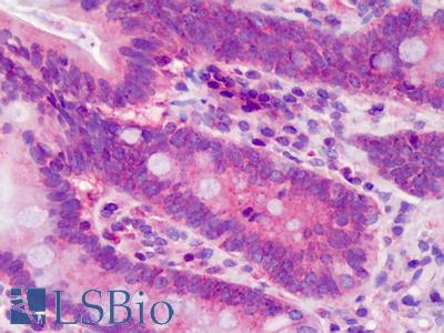 Anti-POLDIP3 / SKAR antibody IHC of human small intestine. Immunohistochemistry of formalin-fixed, paraffin-embedded tissue after heat-induced antigen retrieval. Antibody LS-B3543 concentration 10 ug/ml.
