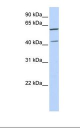 721_B cell lysate. Antibody concentration: 1.0 ug/ml. Gel concentration: 12%.