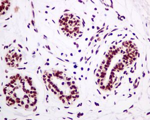 IHC of paraffin-embedded human breast tissue using anti-POLE antibody.
