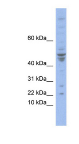 POLE4 antibody LS-C110379 Western blot of COLO205 cell lysate.