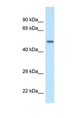 POLG2 antibody LS-C145519 Western blot of Fetal Kidney lysate. Antibody concentration 1 ug/ml.