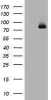 HEK293T cells were transfected with the pCMV6-ENTRY control (Left lane) or pCMV6-ENTRY POLI (Right lane) cDNA for 48 hrs and lysed. Equivalent amounts of cell lysates (5 ug per lane) were separated by SDS-PAGE and immunoblotted with anti-POLI.
