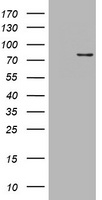 HEK293T cells were transfected with the pCMV6-ENTRY control (Left lane) or pCMV6-ENTRY POLI (Right lane) cDNA for 48 hrs and lysed. Equivalent amounts of cell lysates (5 ug per lane) were separated by SDS-PAGE and immunoblotted with anti-POLI.