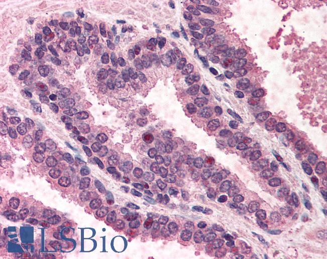 Anti-POLK antibody IHC of human prostate. Immunohistochemistry of formalin-fixed, paraffin-embedded tissue after heat-induced antigen retrieval. Antibody LS-B405 concentration 5 ug/ml.