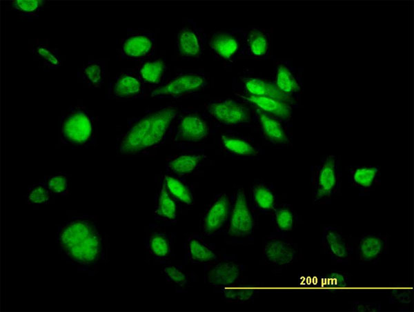 Immunofluorescence of monoclonal antibody to POLK on HeLa cell. [antibody concentration 10 ug/ml]