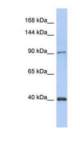 POLK antibody LS-C111194 Western blot of Fetal Kidney lysate.