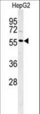 Western blot of POLL Antibody in HepG2 cell line lysates (35 ug/lane). POLL (arrow) was detected using the purified antibody.